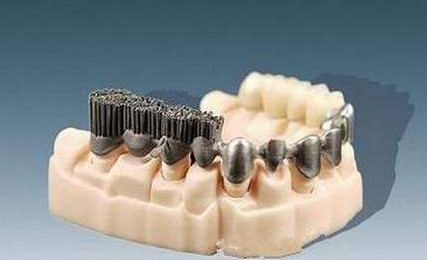 金属3D打印在牙科方面起到什么作用呢？