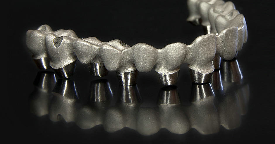 3D打印技术应用在医疗（牙科）