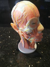 3D打印——医疗术前演练